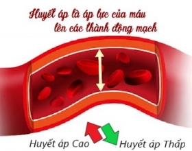 Sau tuổi 50, nam giới mỡ máu cao nên chạy bộ hay tập sức mạnh?